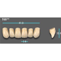 Physiodens Anterior Shade C2 Upper Mould T6S Set 6