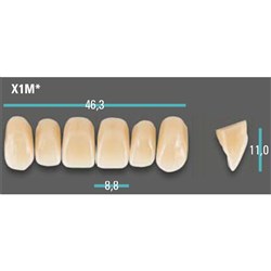 Physiodens Anterior Shade D4 Upper Mould X1M Set 6