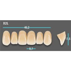 Physiodens Anterior Shade D4 Upper Mould X2L Set 6