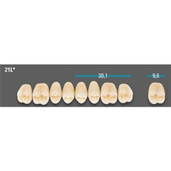 VITA Lingoform Upper Posterior Shade B4 Mould 21L Classical