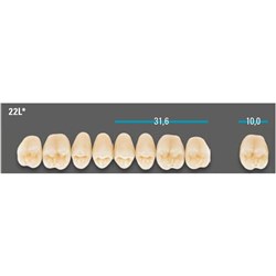 VITA Lingoform Upper Posterior Shade C1 Mould 22L Classical