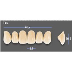 VITAPAN EXCELL Classical Upper Anterior Shade A1 Mould T46