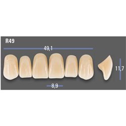 VITAPAN EXCELL Classical Upper Anterior Shade B3 Mould R49
