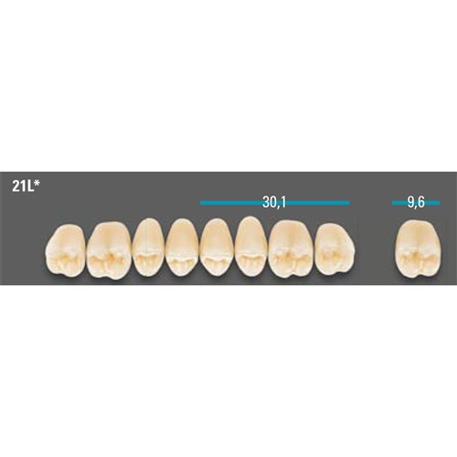 VITA Lingoform Upper Posterior Shade B4 Mould 21L Classical