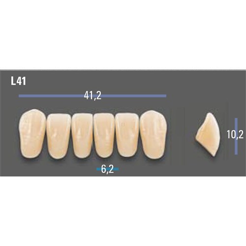 VITAPAN EXCELL Classical Upper Anterior Shade A35 Mould L41